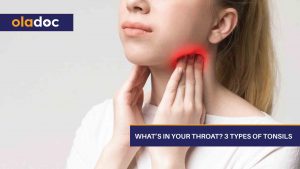 What’s-In-Your-Throat-3-Types-Of-Tonsils
