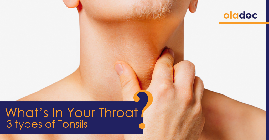 What’s In Your Throat? 3 Types Of Tonsils