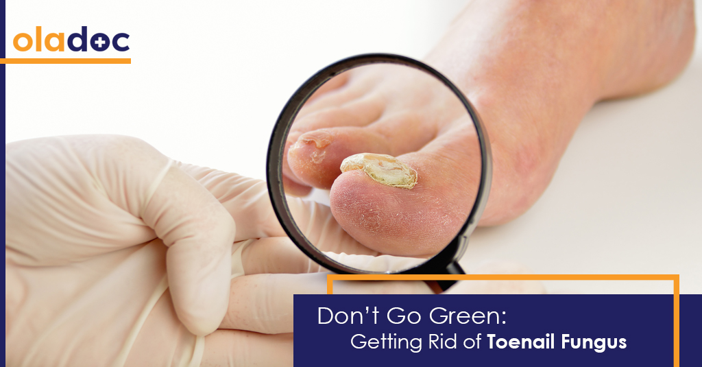 Don’t Go Green: Natural Solutions To Toenail Fungus