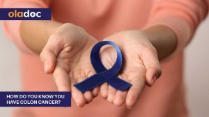 How-Do-You-Know-You-Have-Colon-Cancer