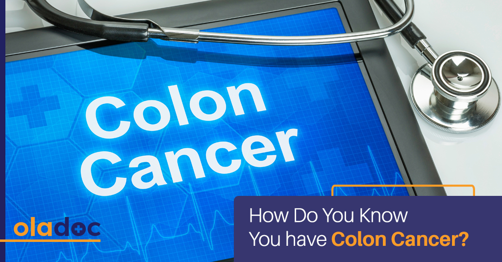 How Do You Know You Have Colon Cancer?