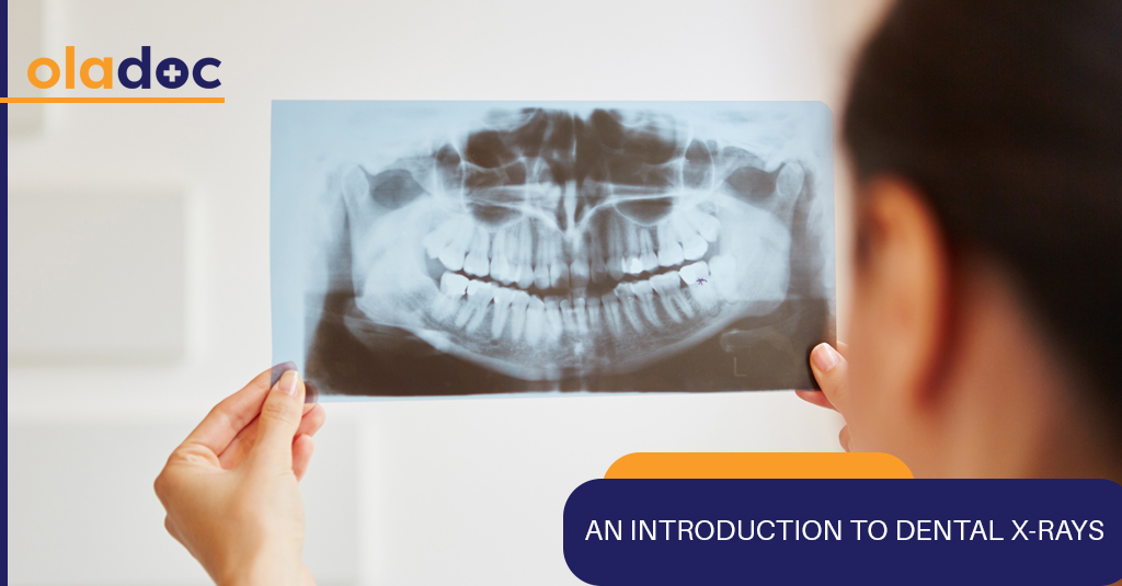 An Introduction To Dental X-rays