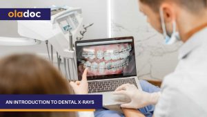 introduction_dental_X_Rays