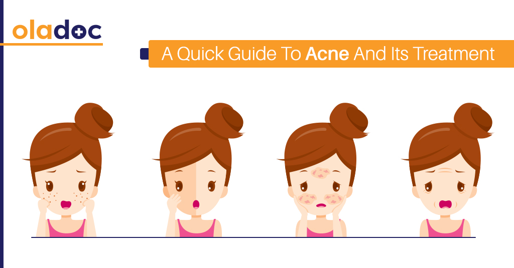 A Quick Guide To Acne And Its Treatment
