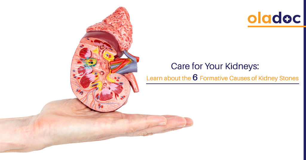 What Causes Kidney Stones And What To Do Harvard Health