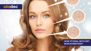 How-To-Deal-With-Dry-Skin-In-Winters