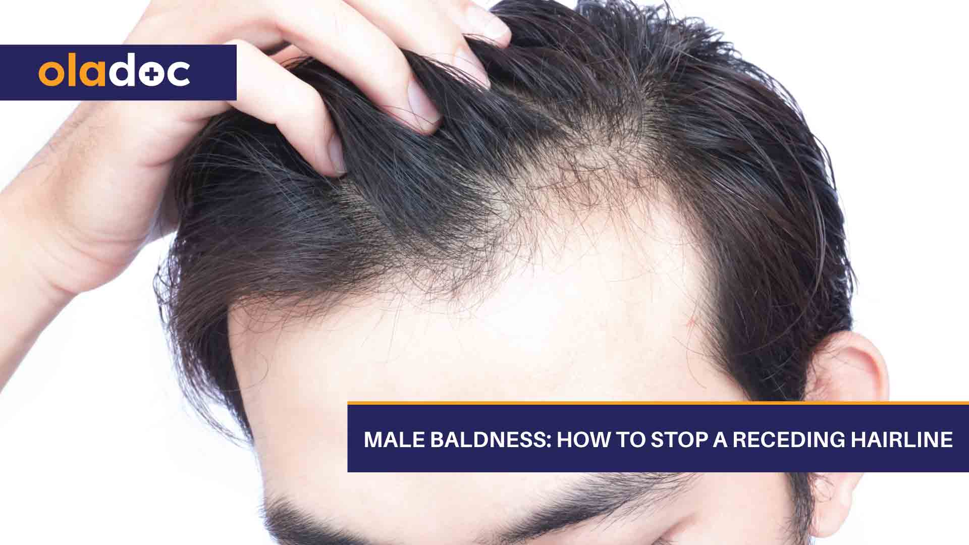 Receding 🌱 can you hairline a reverse Receding Hairline: