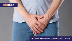 causes of an overactive bladder
