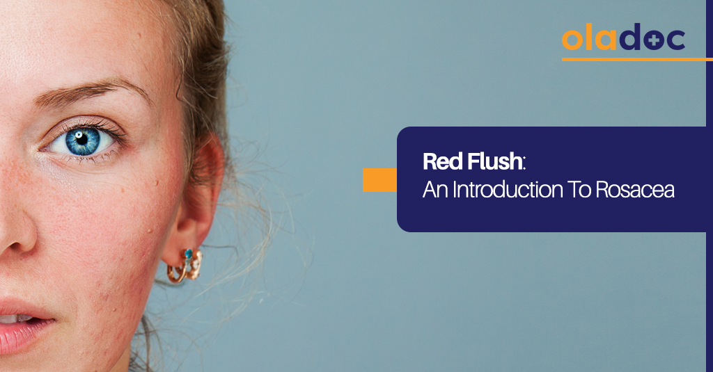 Red Flush: An Introduction to Rosacea