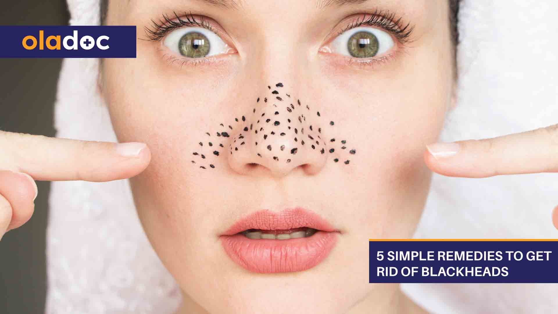 5 Simple Home Remedies to Get Rid of Blackheads hq nude picture