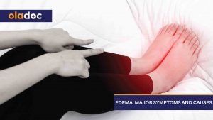 EdemA-Major-Symptoms-and-Causes