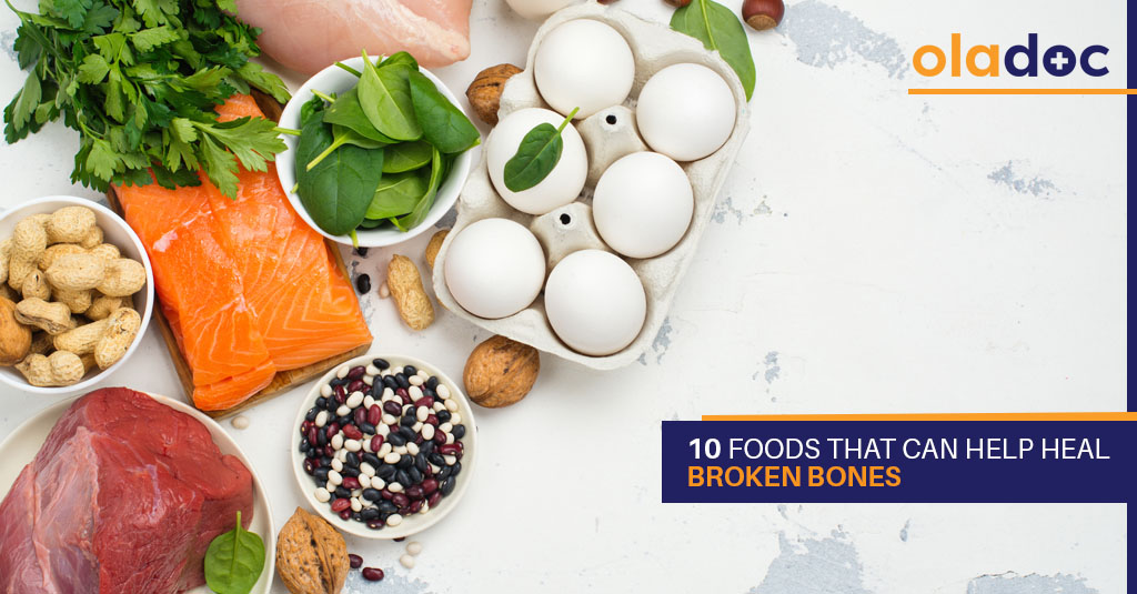 12 Foods That Can Help Heal Broken Bones