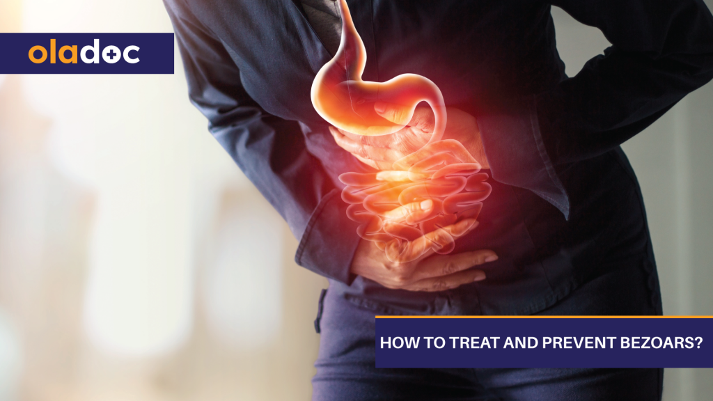 How to Treat and Prevent Bezoars? Digestive Health
