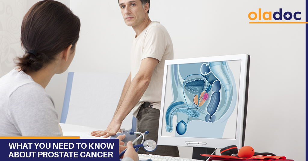 What You Need to Know About Prostate Cancer
