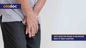 Dry-Skin-on-Penis-6-Reasons-Why-It-May-Happen