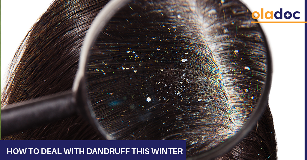 How to Deal With Dandruff This Winter?