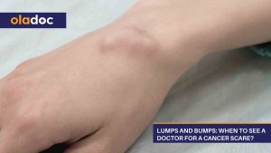 Lumps-And-Bumps-When-To-See-A-Doctor-For-A-Cancer-Scare (1)