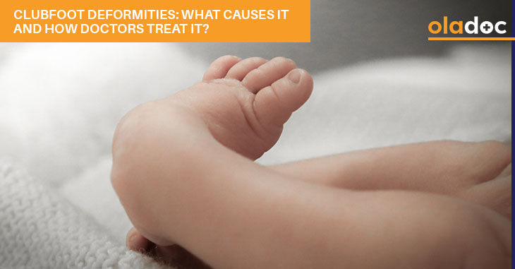 Clubfoot Deformities: What Causes It And How Doctors Treat It?