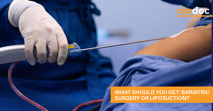 What Should You Get: Bariatric Surgery or Liposuction