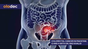 Colorectal-Cancer-In-Pakistan-Q-And-A-With-Dr.-Rao-Khalid