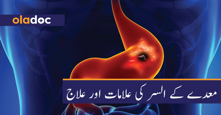 معدے کے السر کی علامات اور علاج