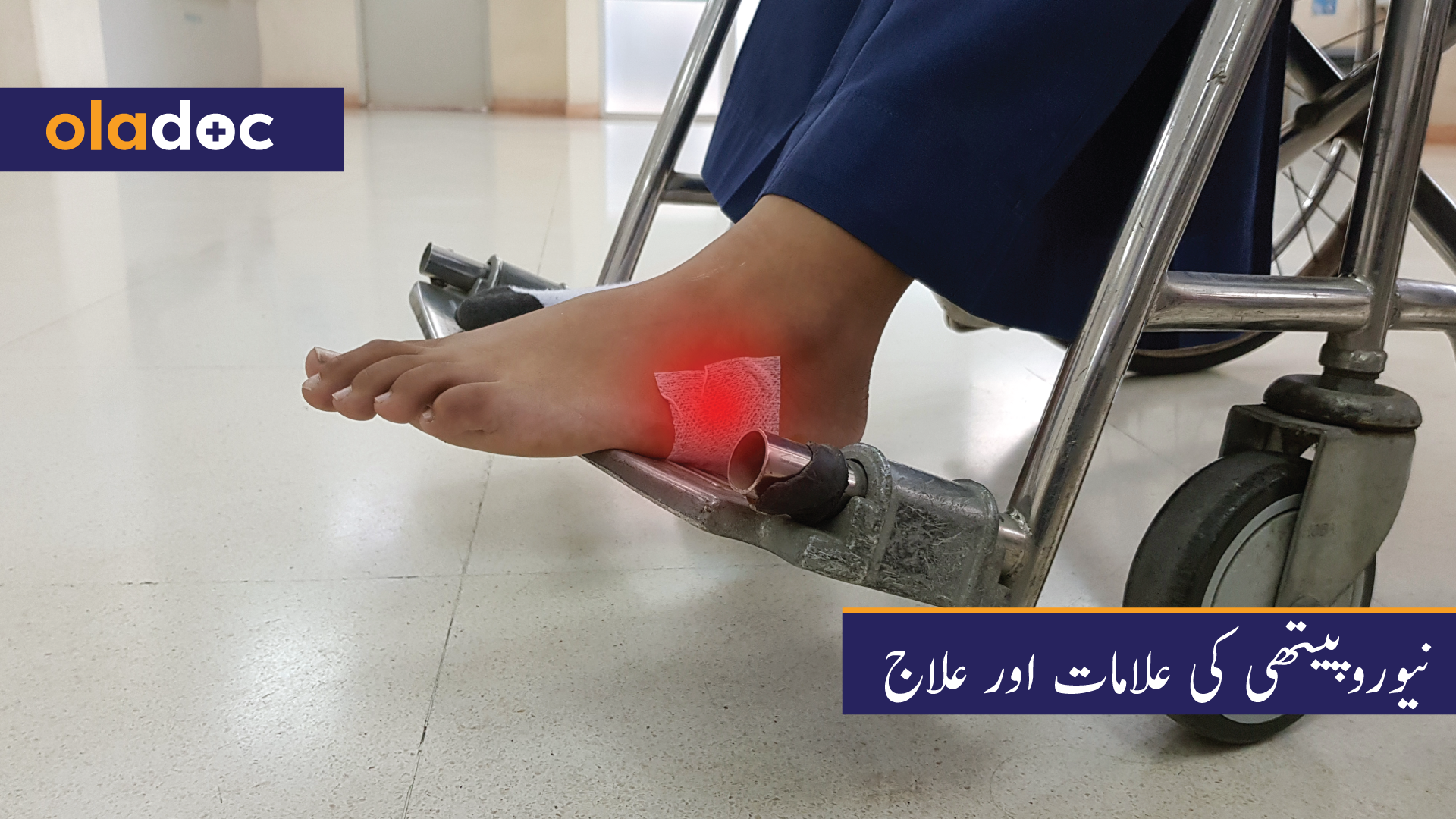 نیوروپیتھی کی علامات اور علاج