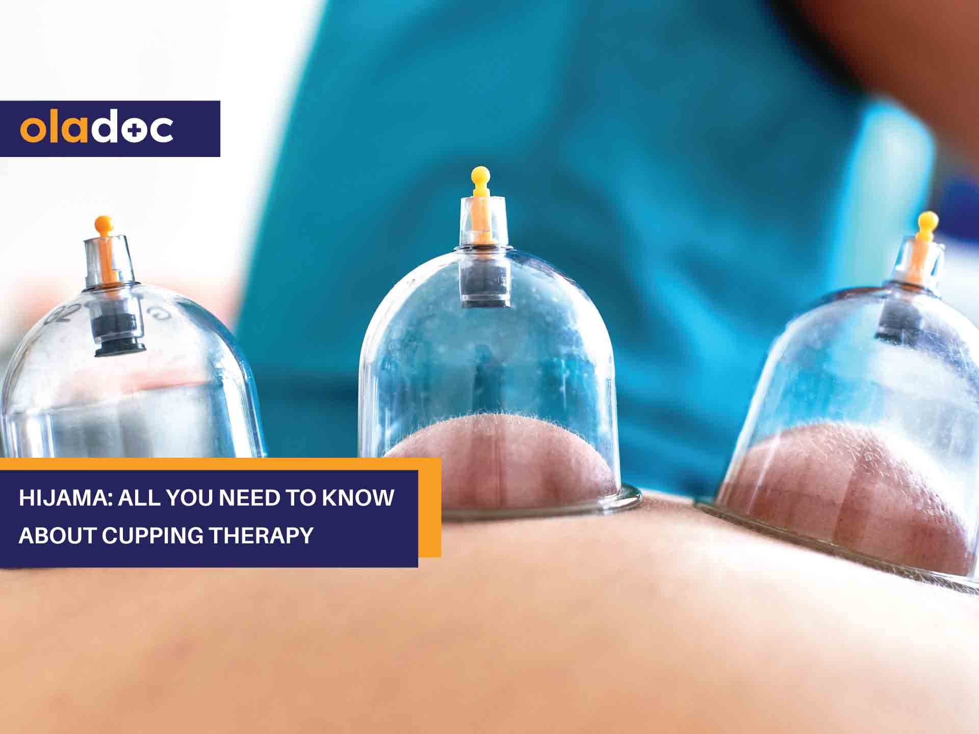 7 Surprising Benefits Of Hijama/Cupping Therapy