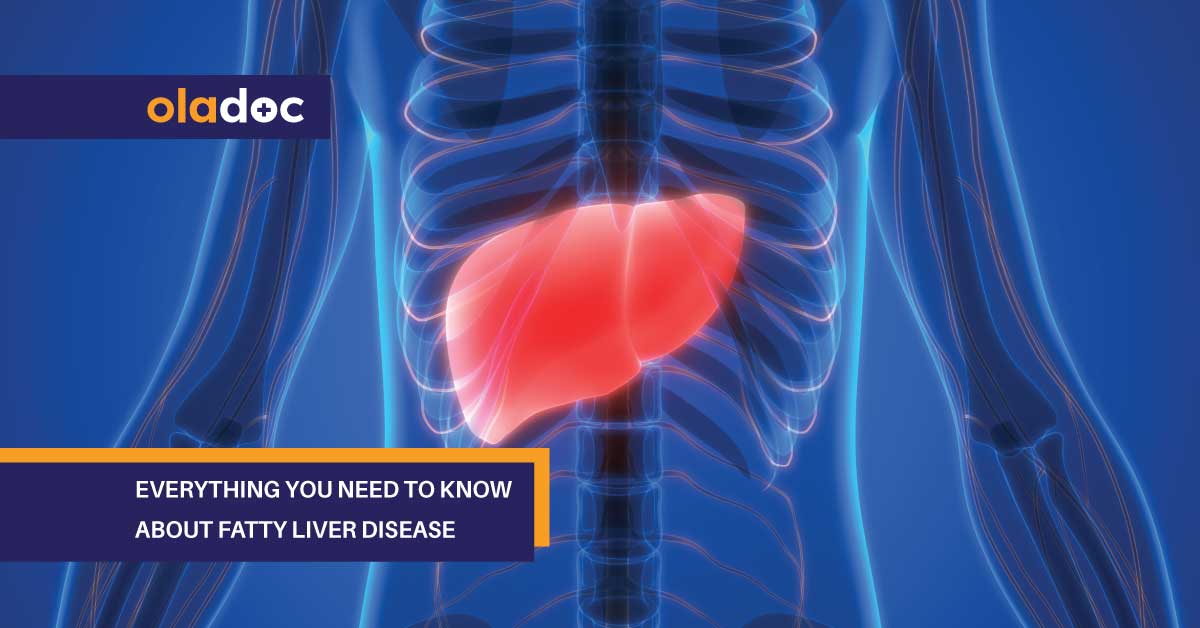 Everything You Need to Know About Fatty Liver Disease