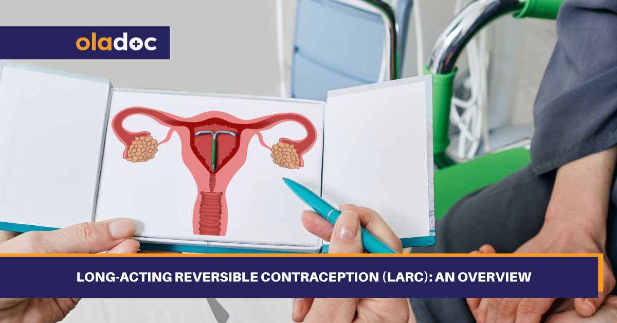 Long-Acting Reversible Contraception (LARC): An Overview