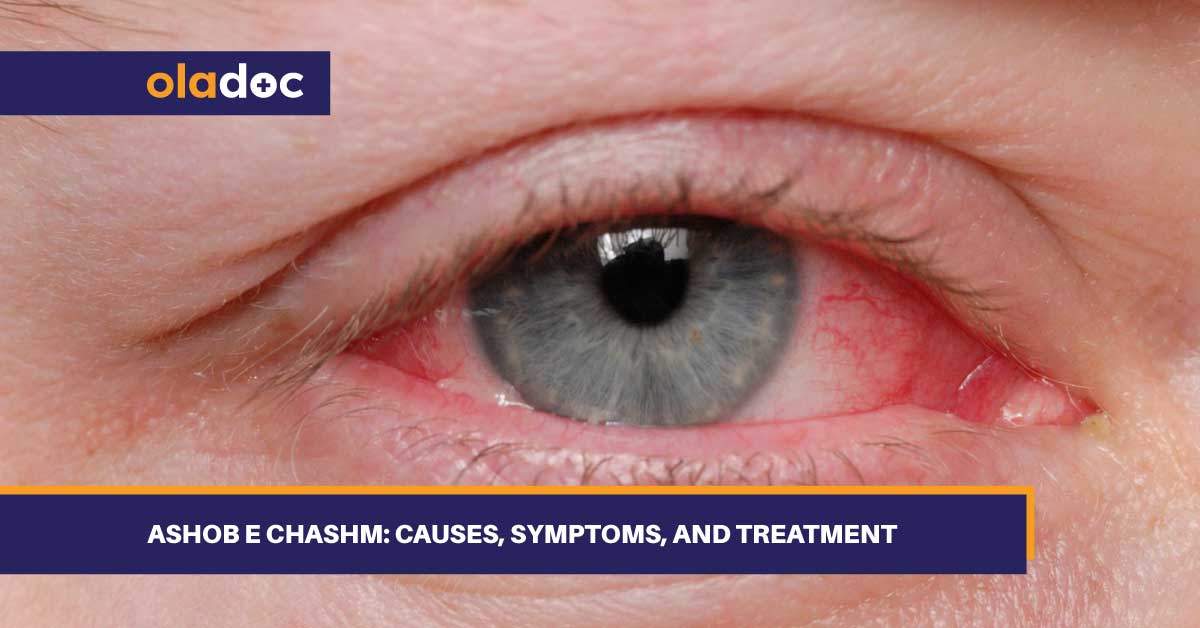 Ashob e Chashm: Causes, Symptoms, and Treatment