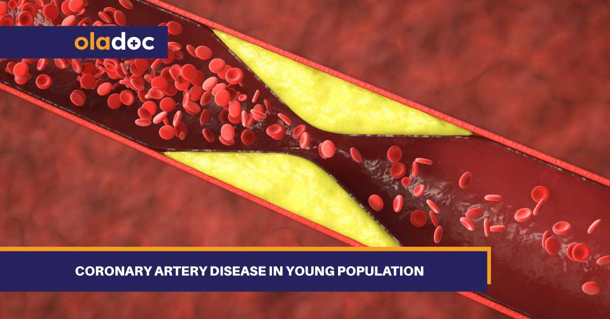 Coronary Artery Disease In Young Population
