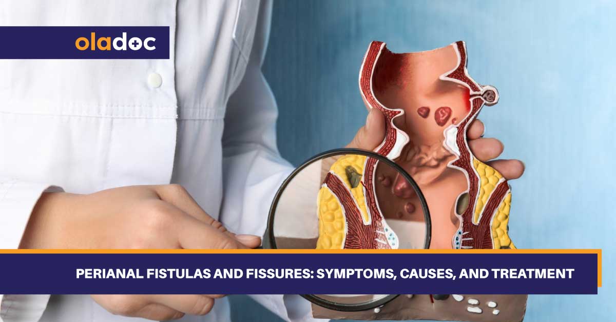 Perianal Fistulas and Fissures: Symptoms, Causes, and Treatment