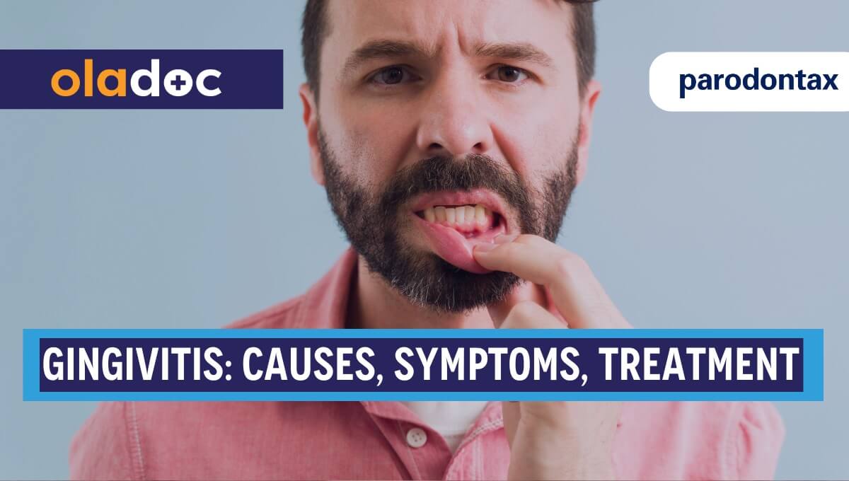 Understanding Gingivitis: A Comprehensive Guide for Gum Health