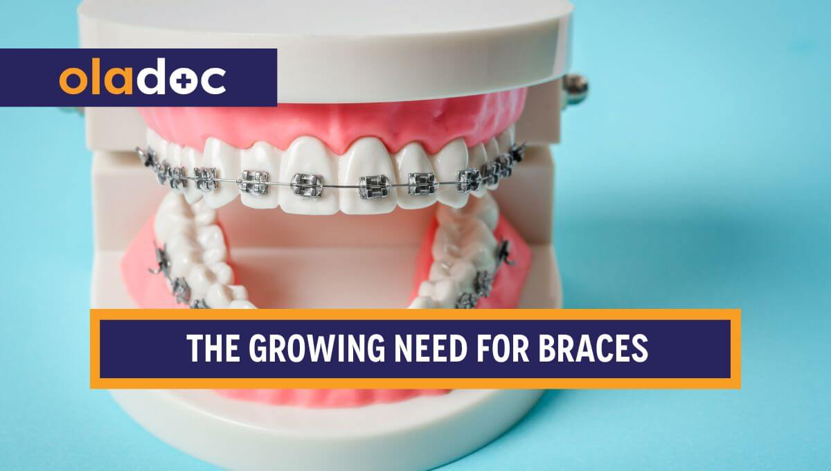 Why Is the Need for Braces Increasing in This Generation?