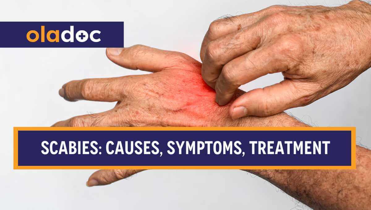 Scabies (Khushk Kharish): Causes, Symptoms & Treatment