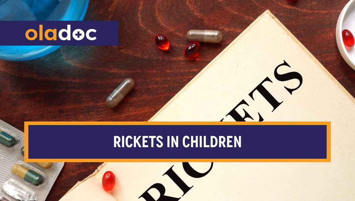 Rickets in Children: Causes, Symptoms, and Treatment