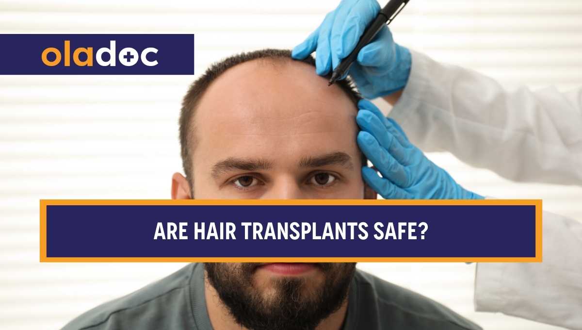 Are Hair Transplants Safe? Understanding The Risk Safety and Outcomes